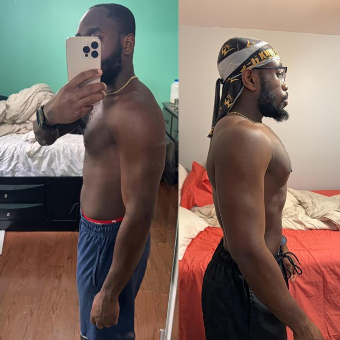 Josh — Before and After